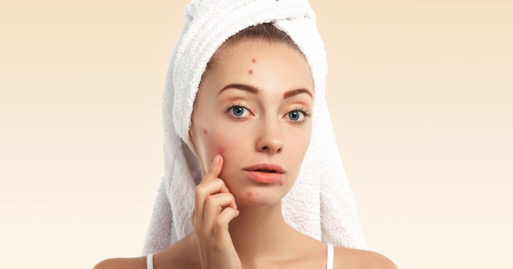 How Does Spot Treatment Work and Why Should You Include It in Your Routine?